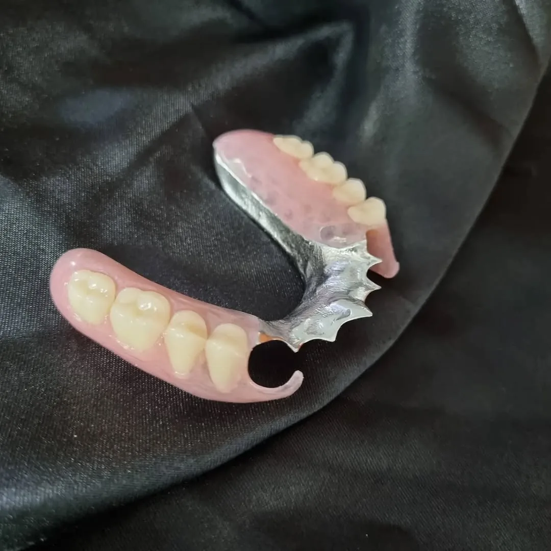 Chrome and flexible combination partial denture
